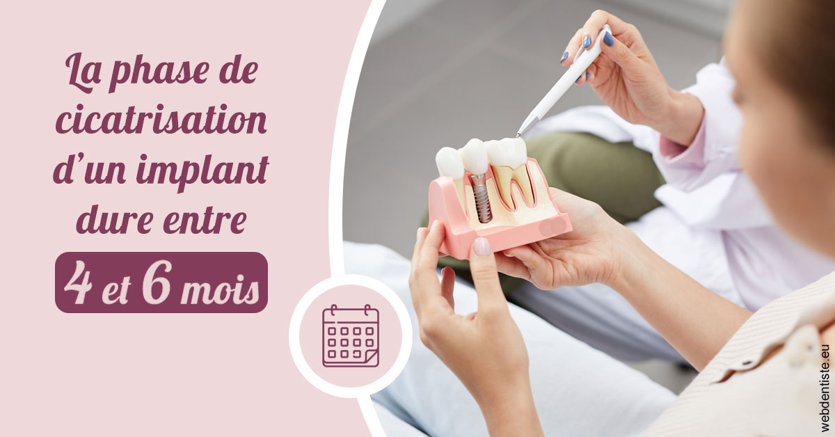 https://dr-thierry-guerin.chirurgiens-dentistes.fr/Cicatrisation implant 2