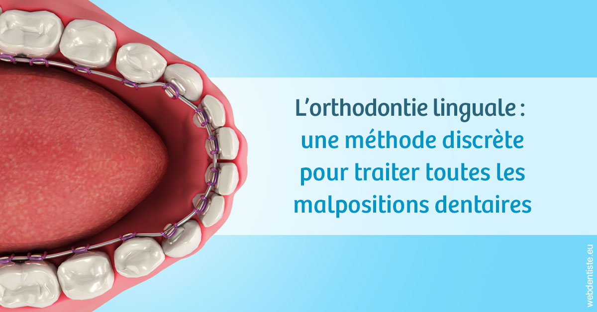 https://dr-thierry-guerin.chirurgiens-dentistes.fr/L'orthodontie linguale 1