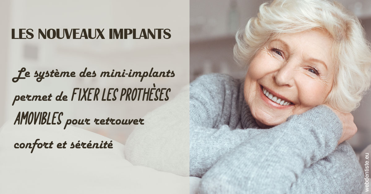 https://dr-thierry-guerin.chirurgiens-dentistes.fr/Les nouveaux implants 1