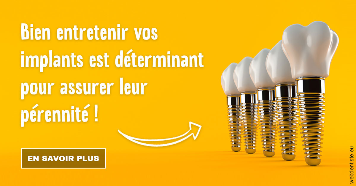 https://dr-thierry-guerin.chirurgiens-dentistes.fr/Entretien implants 2
