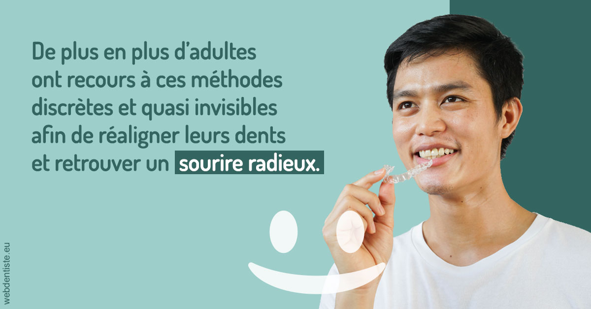 https://dr-thierry-guerin.chirurgiens-dentistes.fr/Gouttières sourire radieux 2