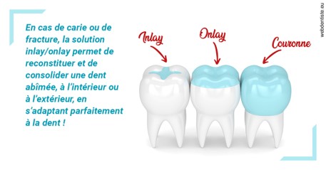 https://dr-thierry-guerin.chirurgiens-dentistes.fr/L'INLAY ou l'ONLAY