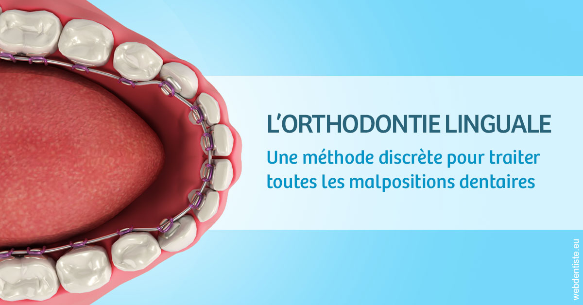 https://dr-thierry-guerin.chirurgiens-dentistes.fr/L'orthodontie linguale 1