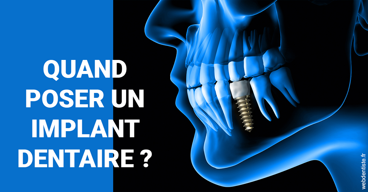 https://dr-thierry-guerin.chirurgiens-dentistes.fr/Les implants 1