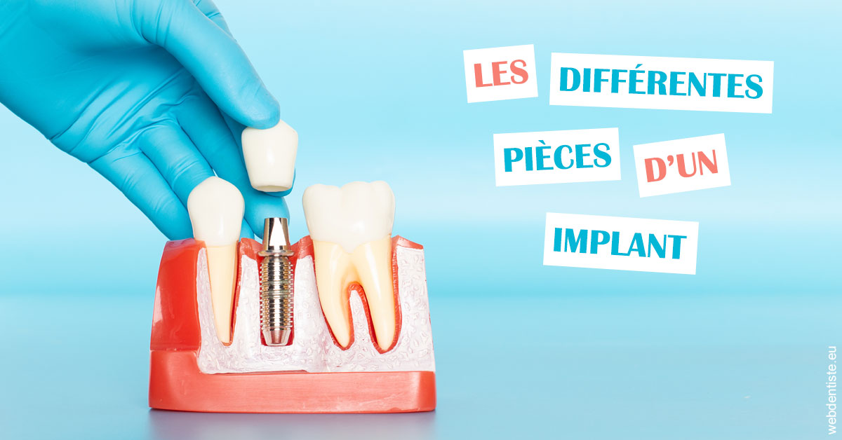 https://dr-thierry-guerin.chirurgiens-dentistes.fr/Les différentes pièces d’un implant 2