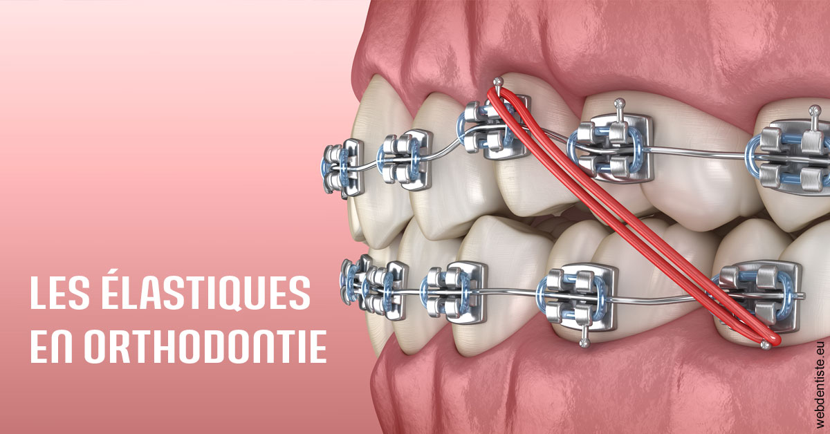 https://dr-thierry-guerin.chirurgiens-dentistes.fr/Elastiques orthodontie 2