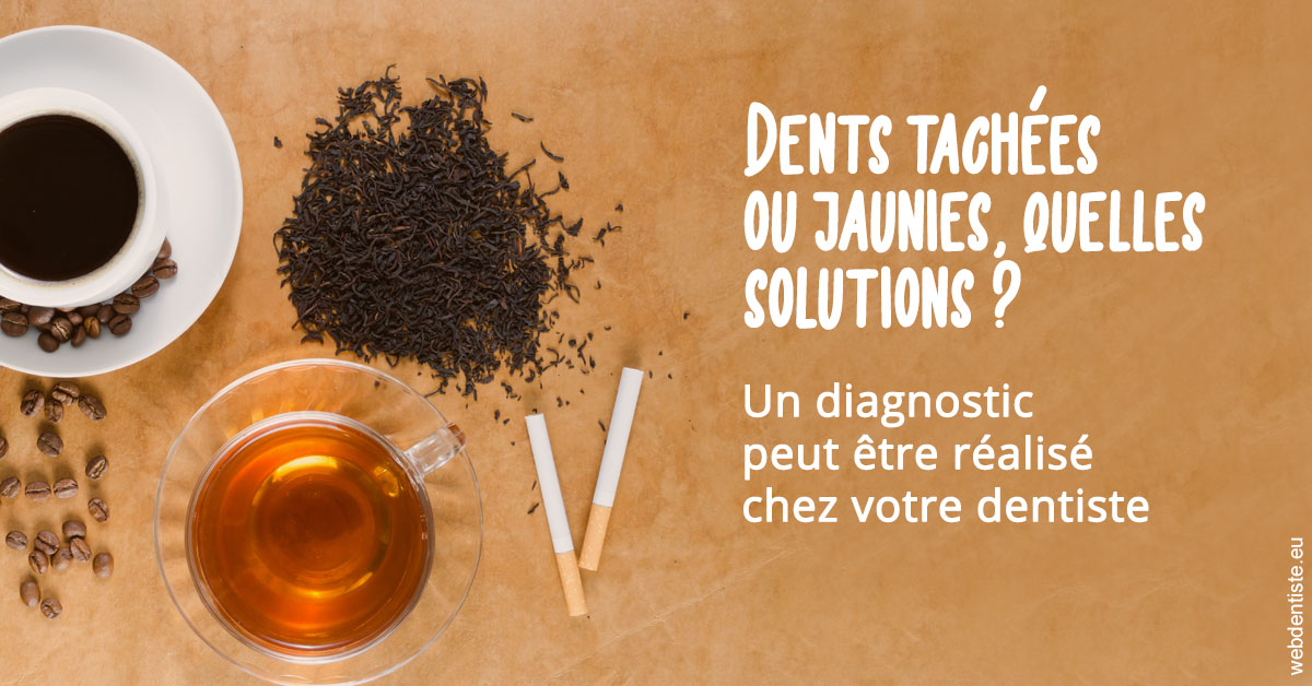 https://dr-thierry-guerin.chirurgiens-dentistes.fr/Dents tachées 2