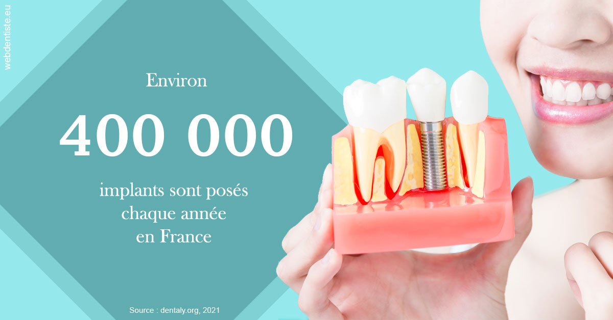 https://dr-thierry-guerin.chirurgiens-dentistes.fr/Pose d'implants en France 2